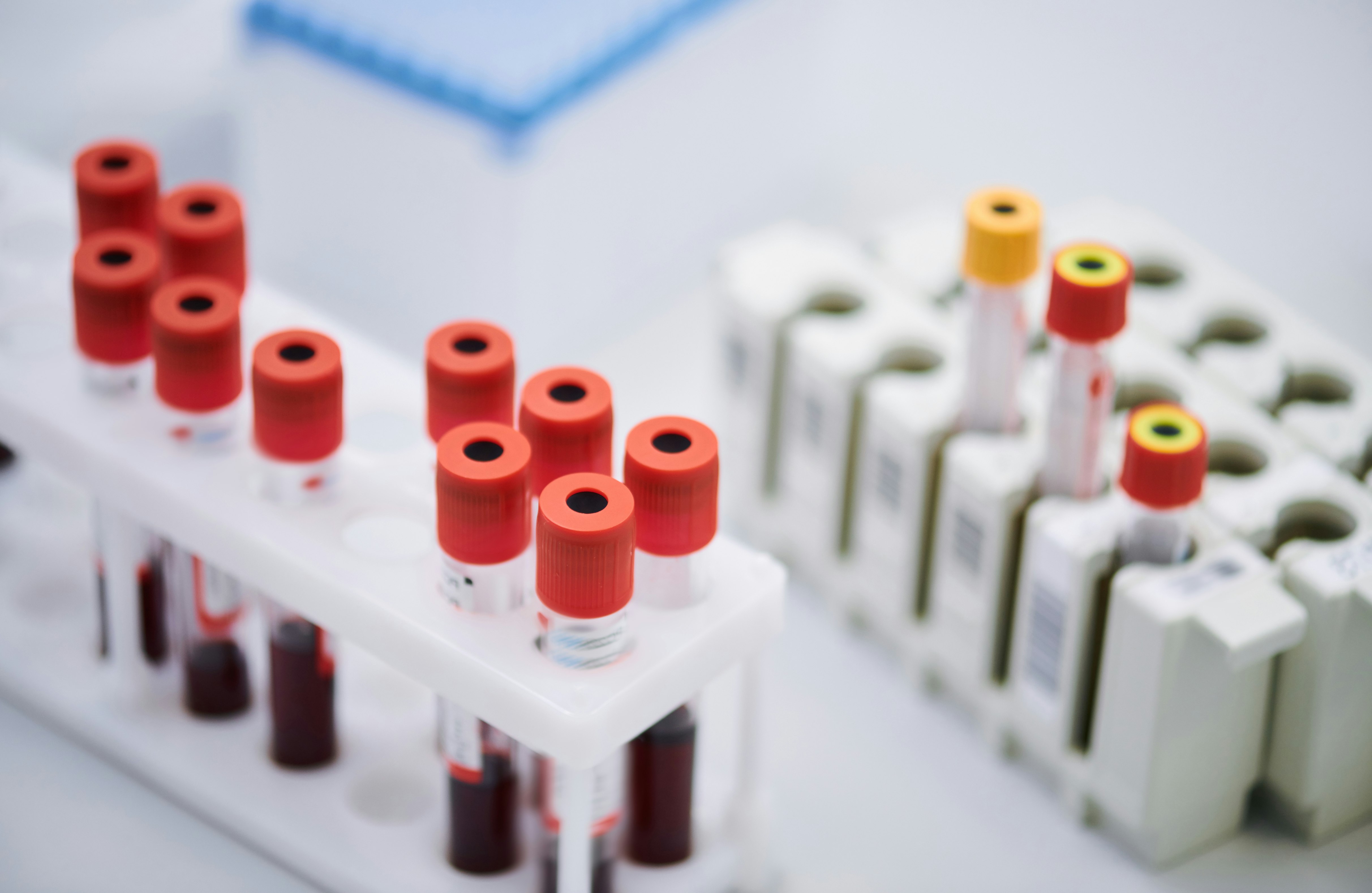 DOT Drug and Alcohol Testing for CDL Drivers  